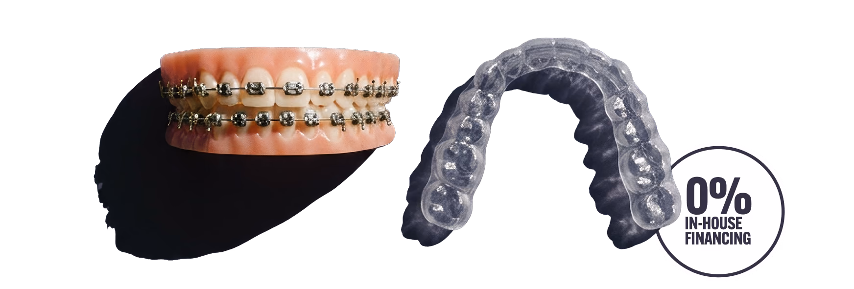 Metal braces alongside a clear aligner — 0% in-house financing available